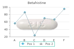 buy betahistine 16mg amex