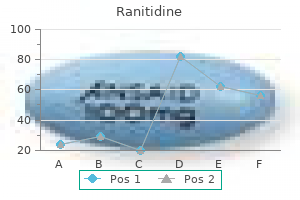 buy ranitidine 300 mg amex