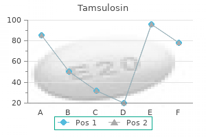 purchase tamsulosin 0.2 mg visa