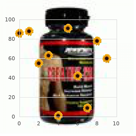 Vasovagal syncope