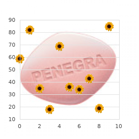 Warm-reacting-antibody hemolytic anemia