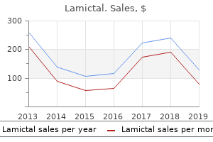 cheap 25mg lamictal overnight delivery