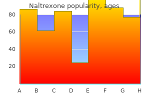 50 mg naltrexone visa