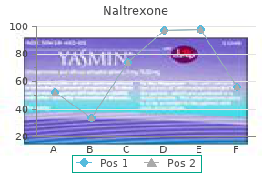 buy cheap naltrexone 50mg on line