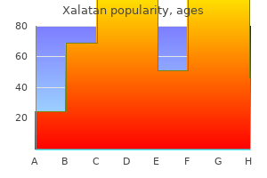 buy xalatan 2.5 ml lowest price