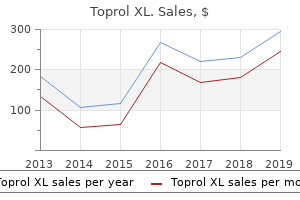 buy toprol xl master card