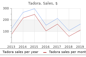order tadora on line